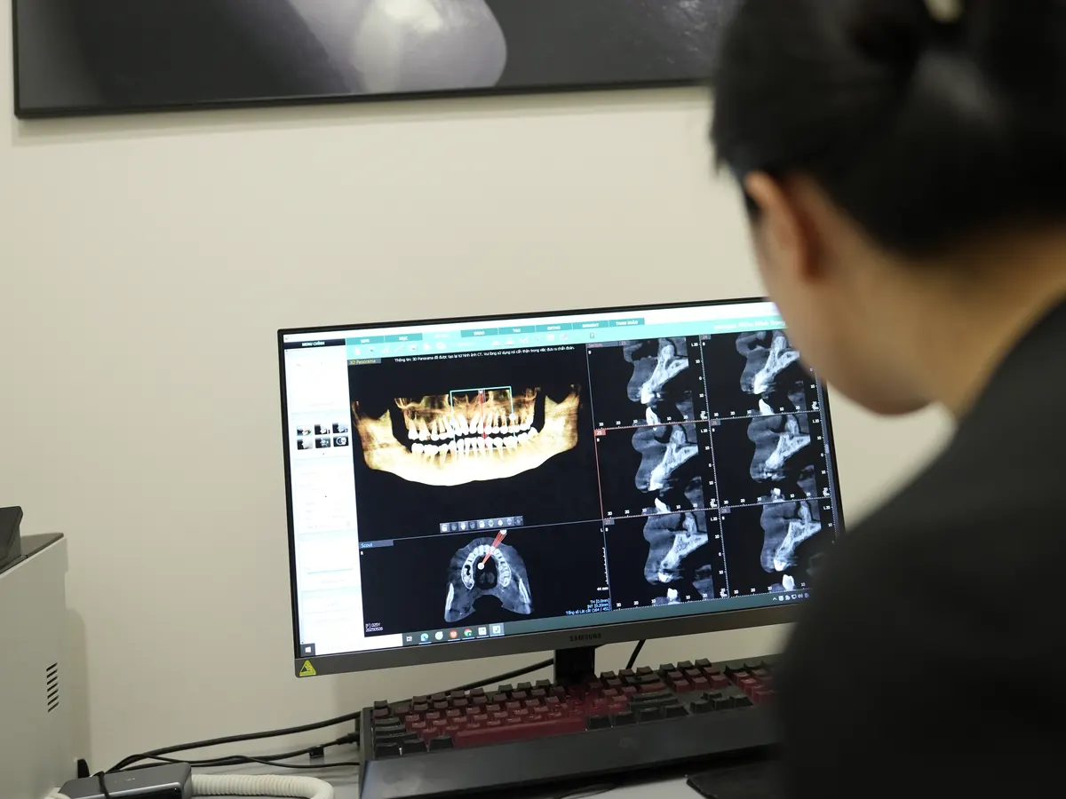 Bác sĩ xem hình dựng 3D xương hàm và các lát cắt CBCT trên máy trạm