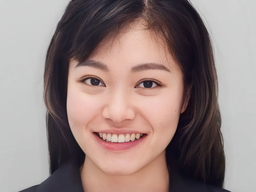 Niềng răng - Sau