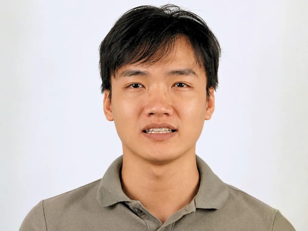 Niềng răng - Sau