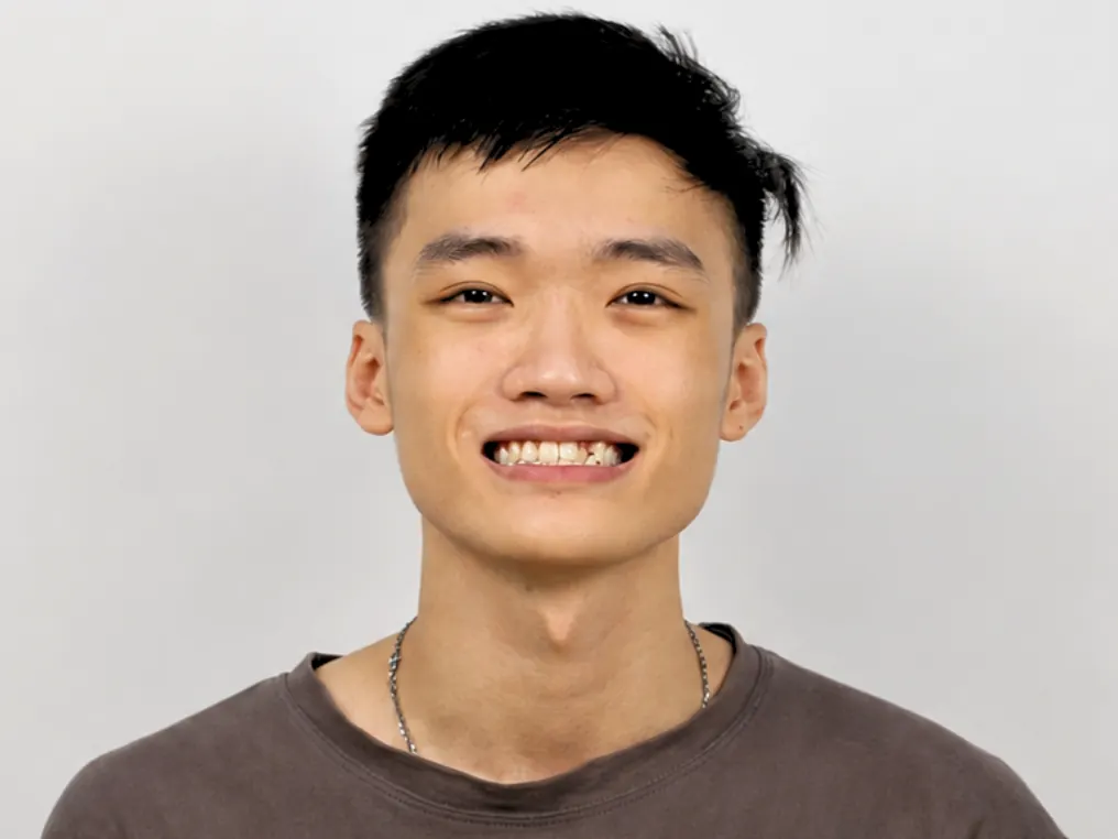 Niềng răng - Trước